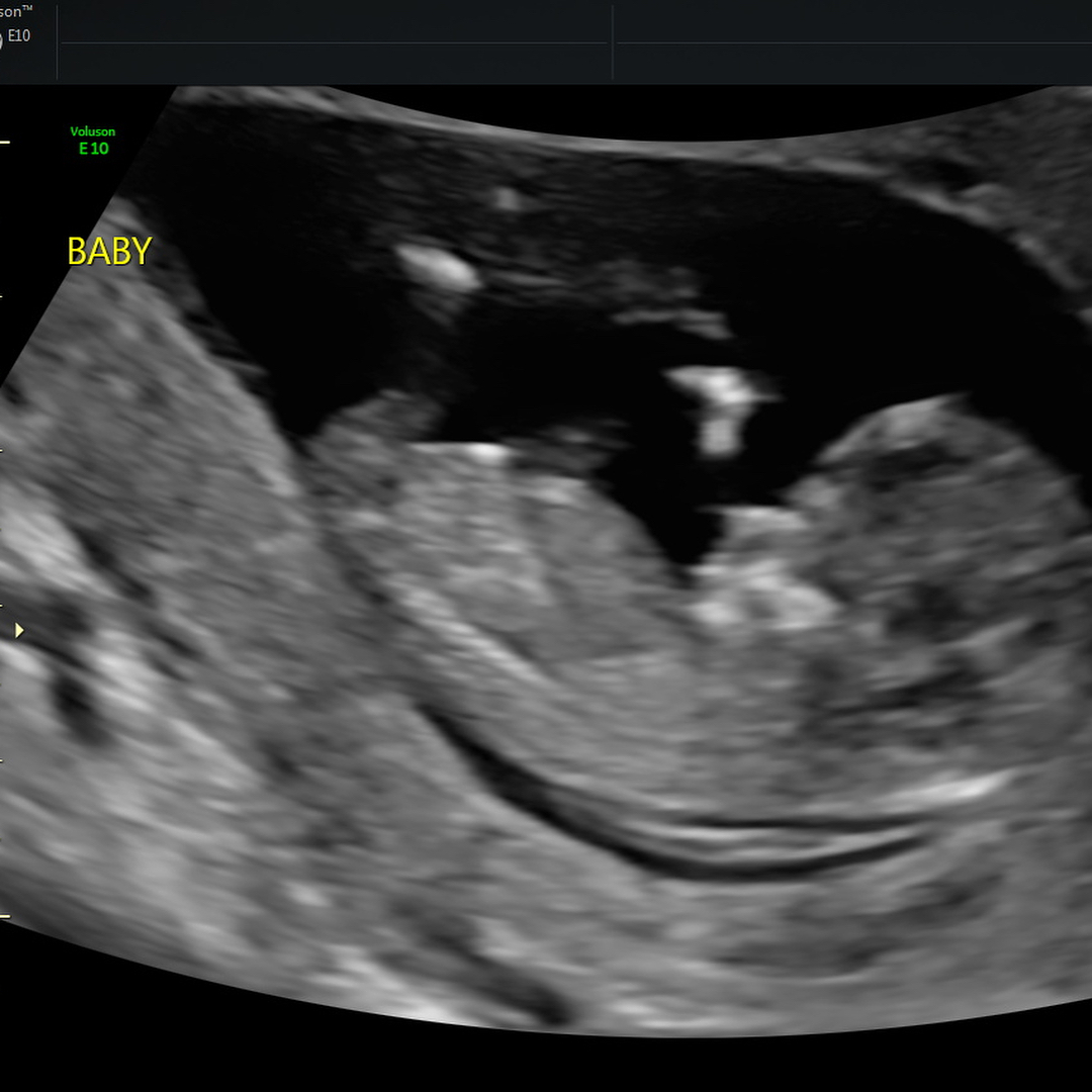 31790863_10210786808446557_276660365616480256_o